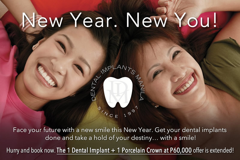 Dental-Implants-Manila_Promotion-Offer_1-Porcelain-Crown_plus_1-Dental-Implant_Equals_60k